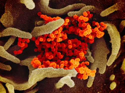 Virus corona chủng mới trông ra sao dưới kính hiển vi?